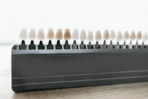 Zahnbleaching Strahlend weiße Zähne für mehr Selbstbewusstsein